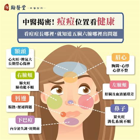 眉心長痘痘運勢|臉上痘痘影響運勢 8部位對應不同危機